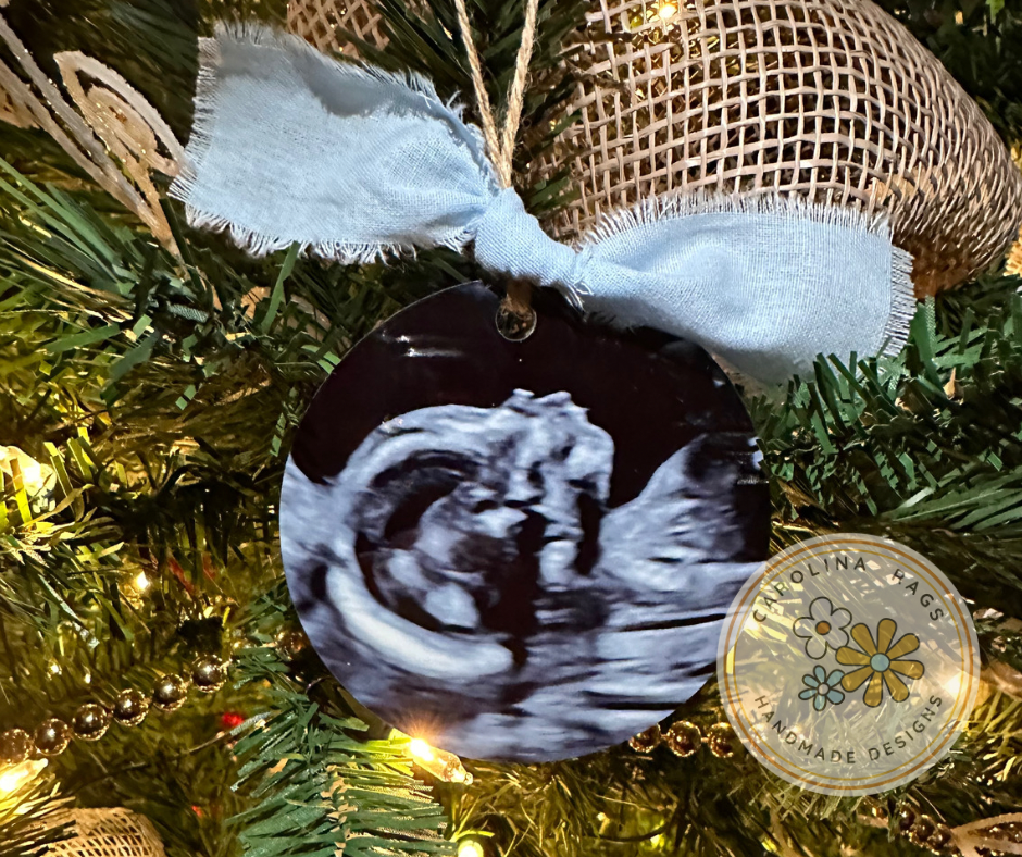 Ultrasound Ornament
